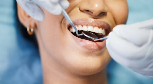 Best Dentist for Tooth Abscess  in Starkville, MS
